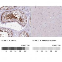 Anti-DDHD1 antibody produced in rabbit 