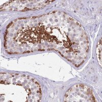 Anti-DDHD1 antibody produced in rabbit 