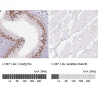 Anti-DDX17 antibody produced in rabbit 