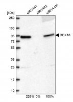 Anti-DDX18 antibody produced in rabbit HPA041056-100UL