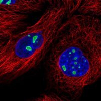 Anti-DDX18 antibody produced in rabbit HPA041056-100UL