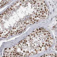 Anti-DDX42 antibody produced in rabbit 