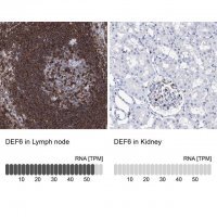 Anti-DEF6 antibody produced in rabbit 