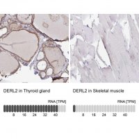 Anti-DERL2 antibody produced in rabbit 