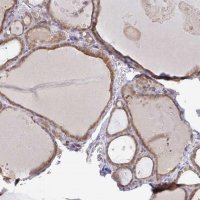Anti-DERL2 antibody produced in rabbit 