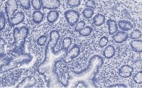 Anti-Derlin-1 Antibody, clone 2C2, ZooMAb� Rabbit Monoclonal 