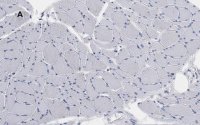 Anti-Desmin Antibody, clone 1H16, ZooMAb� Rabbit Monoclonal 