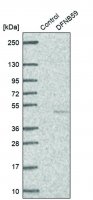 Anti-DFNB59 antibody produced in rabbit