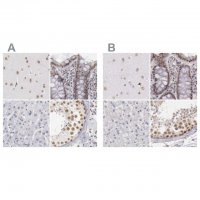 Anti-DGCR14 antibody produced in rabbit HPA001221-100UL