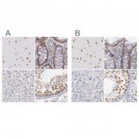 Anti-DGCR14 antibody produced in rabbit HPA001222-100UL