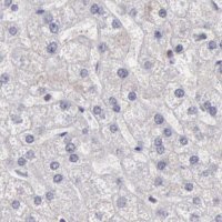 Anti-DGCR14 antibody produced in rabbit HPA001222-100UL