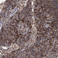 Anti-DGKA antibody produced in rabbit 