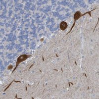 Anti-DGKZ antibody produced in rabbit 