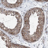Anti-DGUOK antibody produced in rabbit HPA034766-100UL