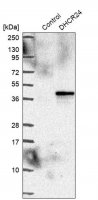 Anti-DHCR24 antibody produced in rabbit HPA063005-100UL