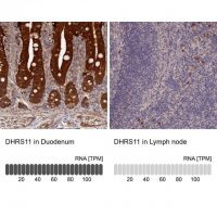 Anti-DHRS11 antibody produced in rabbit 