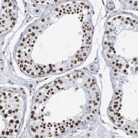Anti-DHX16 antibody produced in rabbit 