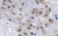 Anti-DHX37 Antibody, clone 3I16 ZooMAb� Rabbit Monoclonal 