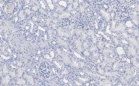 Anti-DIP2B Antibody, clone 2C8, ZooMAb� Rabbit Monoclonal 