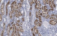 Anti-DIP2B Antibody, clone 2C8, ZooMAb� Rabbit Monoclonal 