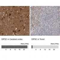 Anti-DIP2C antibody produced in rabbit 