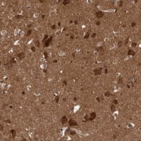 Anti-DIP2C antibody produced in rabbit 