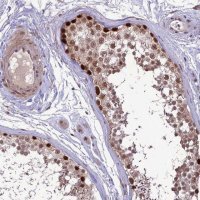 Anti-DIS3 antibody produced in rabbit 