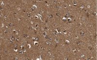 Anti-DKK3 Antibody, clone 3H17 ZooMAb® Rabbit Monoclonal