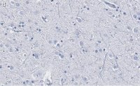 Anti-DKK3 Antibody, clone 3H17 ZooMAb® Rabbit Monoclonal