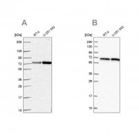 Anti-DLAT antibody produced in rabbit HPA062766-100UL