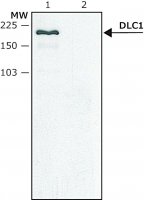 Anti-DLC1 (C-terminal) antibody produced in rabbit SAB4200352-200UL
