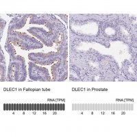 Anti-DLEC1 antibody produced in rabbit 