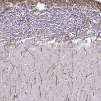 Anti-DLX1 antibody produced in rabbit 