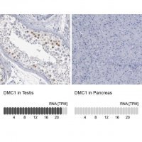 Anti-DMC1 antibody produced in rabbit 