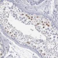 Anti-DMC1 antibody produced in rabbit 