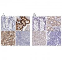 Anti-DMGDH antibody produced in rabbit 