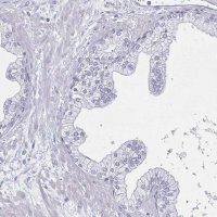 Anti-DMRTB1 antibody produced in rabbit