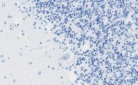 Anti-DNA Polymerase beta Antibody, clone 3F21 ZooMAb� Rabbit Monoclonal 