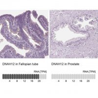 Anti-DNAH12 antibody produced in rabbit