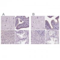 Anti-DNAH12 antibody produced in rabbit