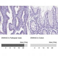 Anti-DNAH2 antibody produced in rabbit 