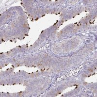 Anti-DNAH9 antibody produced in rabbit 