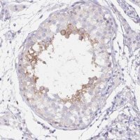 Anti-DNAI2 antibody produced in rabbit 