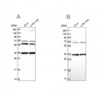 Anti-DNAJC17 antibody produced in rabbit 