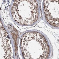 Anti-DNAJC27 antibody produced in rabbit 