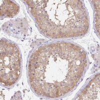 Anti-DNAJC5G antibody produced in rabbit