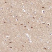 Anti-DNAJC6 antibody produced in rabbit 
