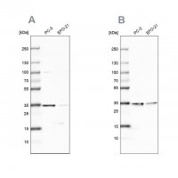 Anti-DNAJC9 antibody produced in rabbit