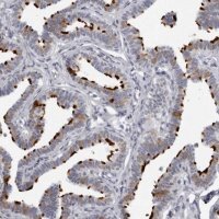 Anti-DNALI1 antibody produced in rabbit 