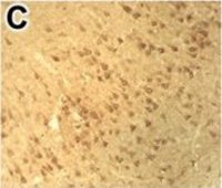 Anti-DNMT1 antibody produced in rabbit 